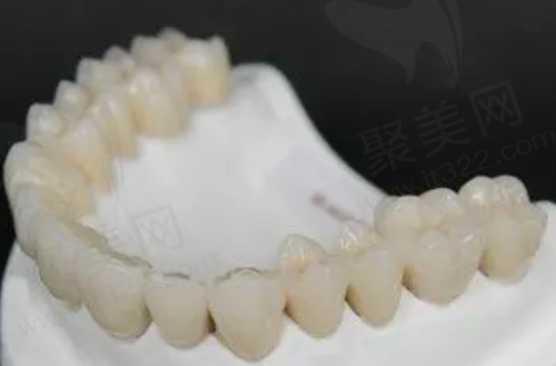 不同价格的全瓷牙使用寿命不同