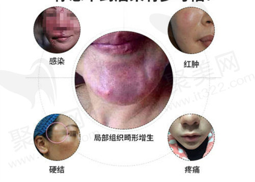 广州荔湾区人民医院异物取出好吗？