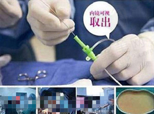 广州荔湾区人民医院