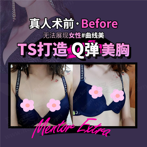 求美者术前的样子