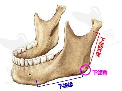 下颌角切除的费用因素有哪些？