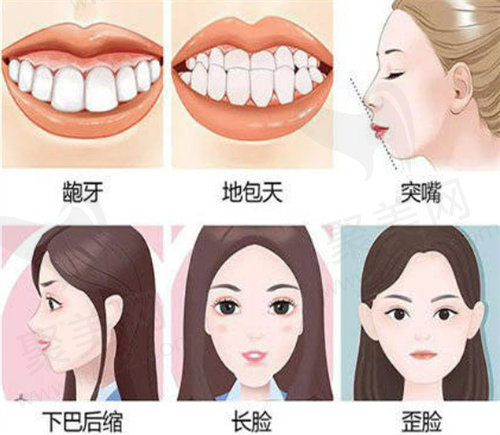 何锦泉正颌得多少钱？