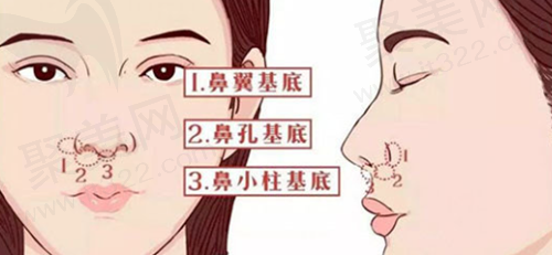 鼻基底填充