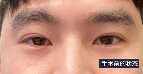 手术前的样子