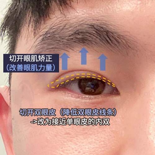 求美者改善的部位