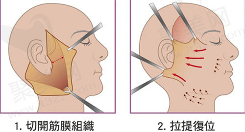 黄广香医生怎么预约？