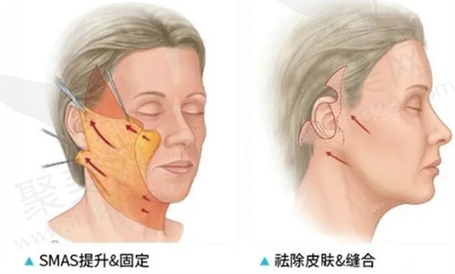 黄广香医生怎么预约？