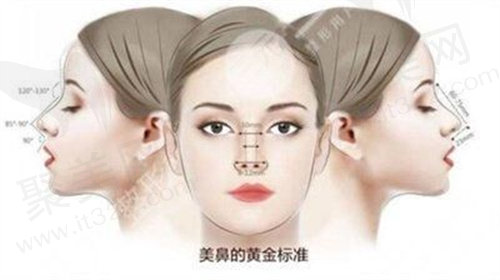 鼻整形