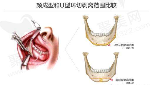 张笑天10万 能做吗？