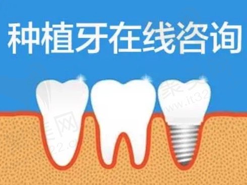广州种植牙在线咨询