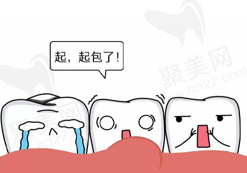牙龈脓肿