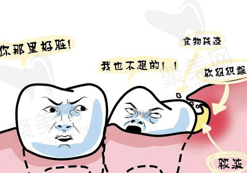 牙龈脓肿
