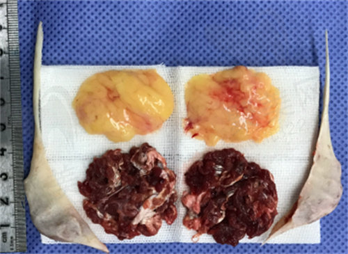 穆雄铮磨骨技术怎么样？