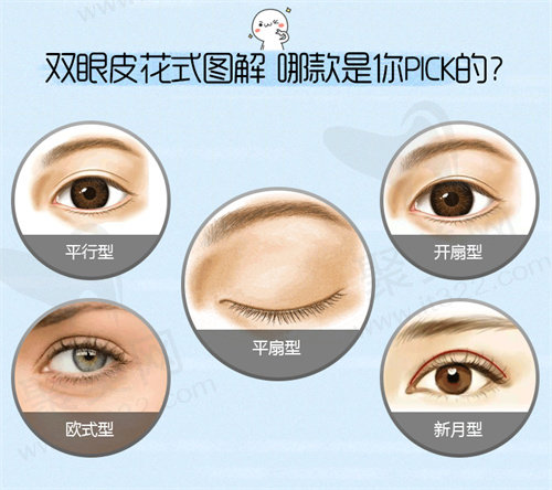 双眼皮