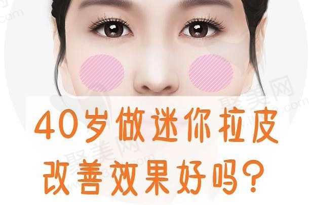 面部拉皮适合哪个年龄段？