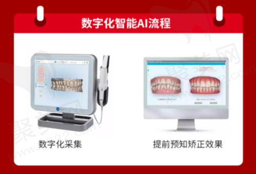 数字化正畸和传统正畸有什么区别
