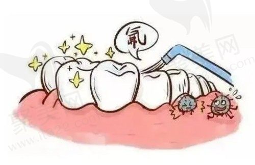 涂氟的好处