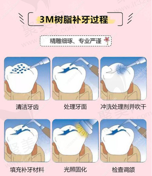 补牙