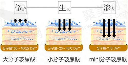 玻尿酸