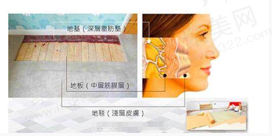 祝东升医生的面部五层生物性提升：