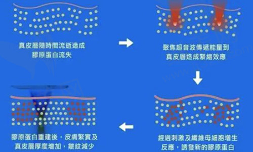 7d聚拉提