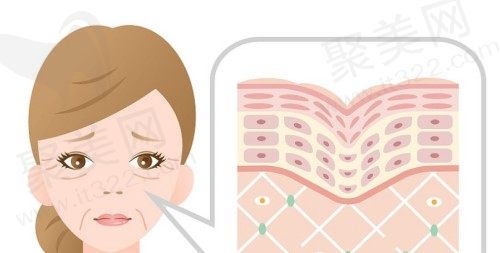 热玛吉