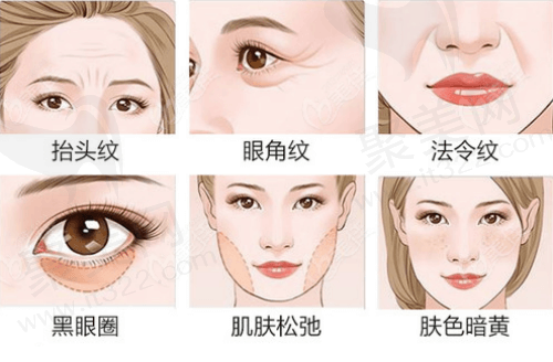 热玛吉可做部位