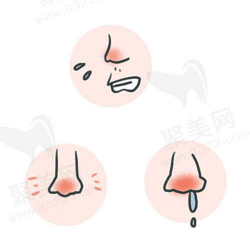功能性