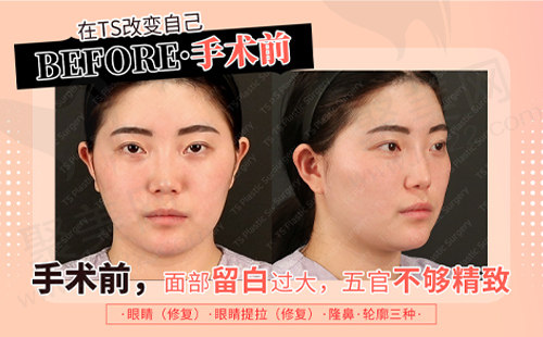 求美者术前的样子