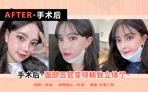 求美者术后恢复变化