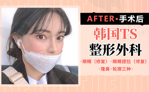 求美者术后恢复变化
