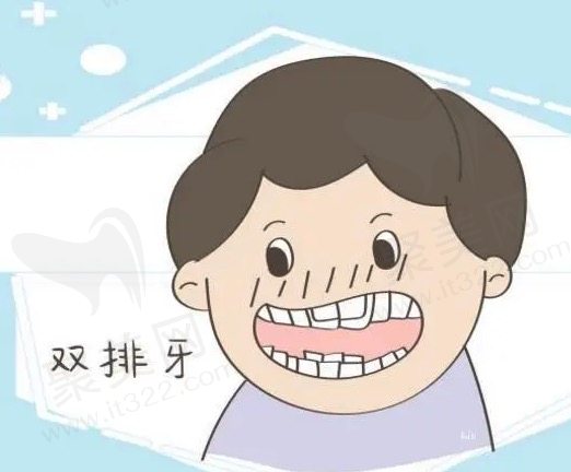 儿童双排牙该怎么 处理