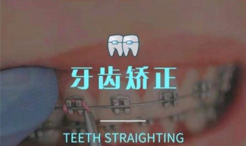 上海雅悦齿科牙齿矫正