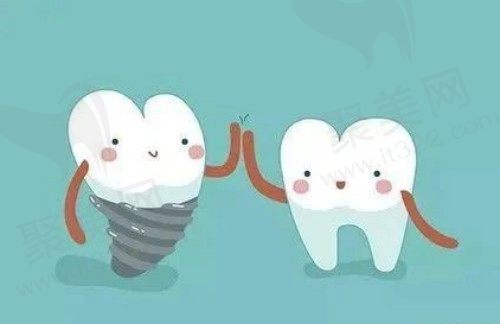 无锡种植牙价格