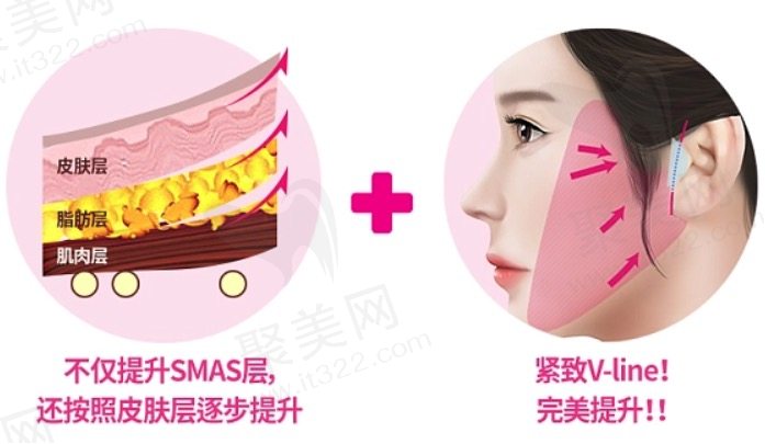全脸拉皮除皱手术费用一览表