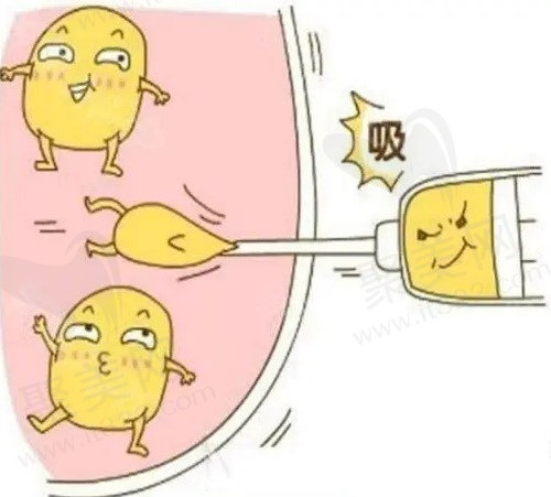 黄金微雕