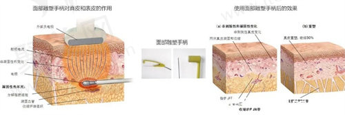 黄金微雕