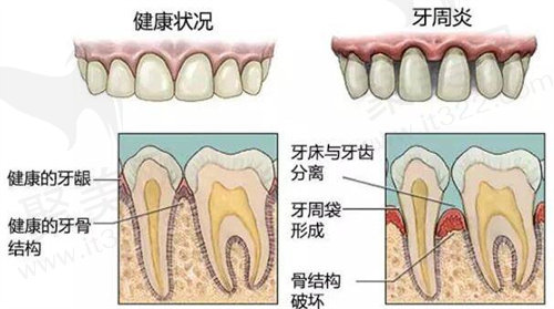 口腔健康