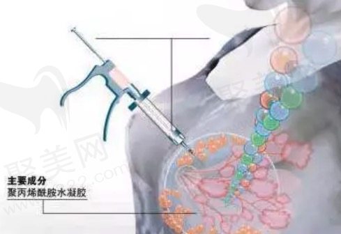 奥美定取出哪家医院好
