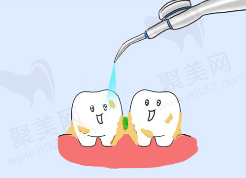 洗牙