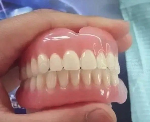 不磨牙镶牙的方法有哪些