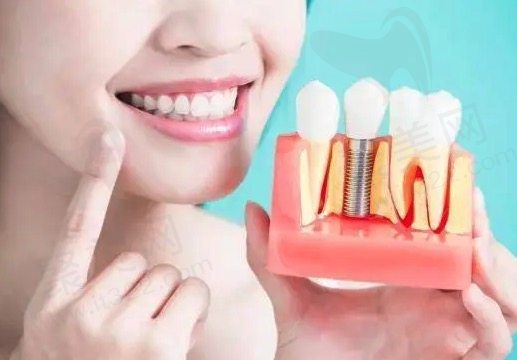 不磨牙修复缺牙哪种方法比较好