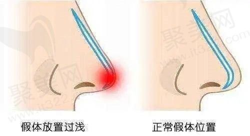 北京鼻修复排名前十的医生