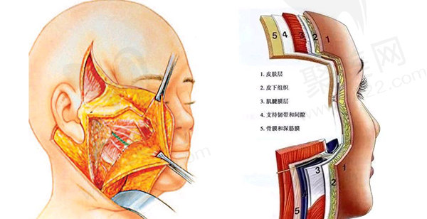 袁强拉皮手术做得怎么样