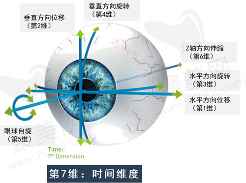 近视手术