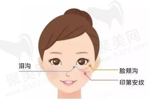 如何预防和减少猫咪纹的形成
