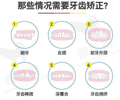 管理标准