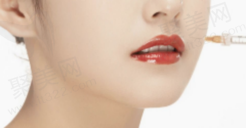 玻尿酸打完几天<span style=