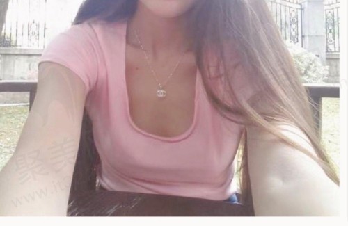 上海艺星陈成医生假体隆胸