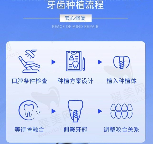 宁波奉化口腔医院做种植牙好不好？
